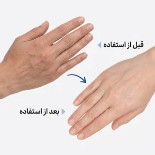 کرم مرطوب کننده دست سری کیت مدل Nourishing   مناسب برای انواع پوست وزن ۵۰گرم 102771703